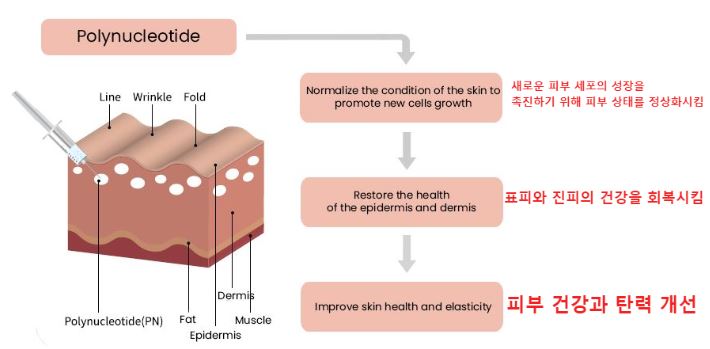 리쥬란힐러-작용-원리